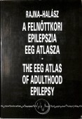 A felnőttkori epilepszia EEG atlasza. The EEG Atlas for Adulthood Epilepsy