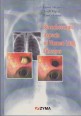 Bronchoscopic Aspects of Human Lung Diseases