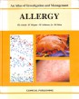 An Atlas of Investigation and Management. Allergy